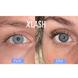 Xlash Eyelash Serum